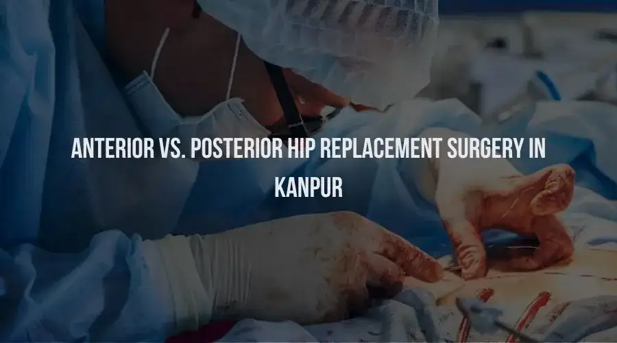 Anterior VS. Posterior Hip Replacement Surgery in Kanpur