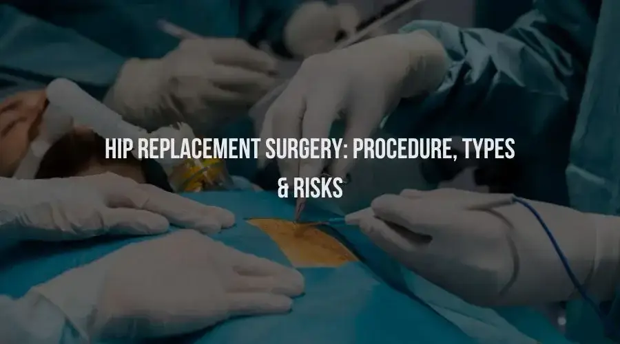 Hip Replacement Surgery: Procedure, Types & Risks